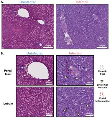 Hepatic and pulmonary macrophage activity in a mucosal challenge model of Ebola virus disease